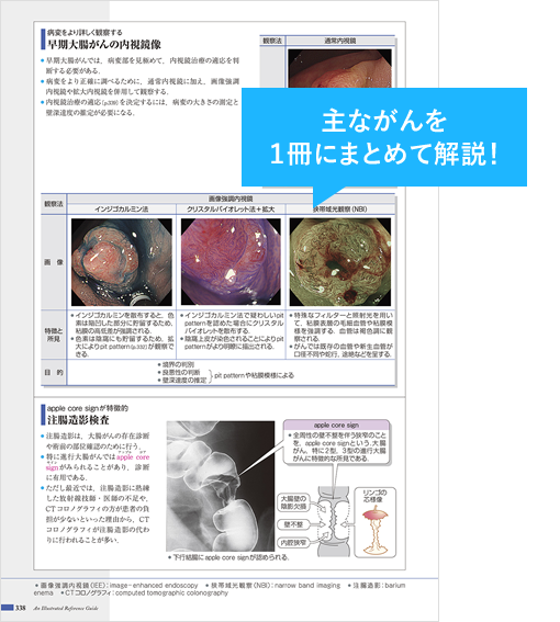 主ながんを１冊にまとめて解説！