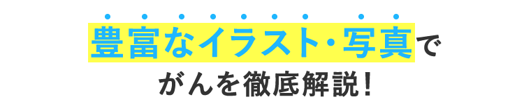 豊富なイラスト・写真でがんを徹底解説！